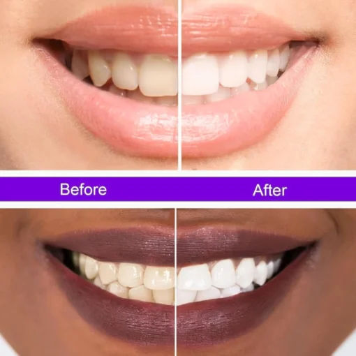 Hismile v34 Colour Corrector, Purple Teeth Whitening, Tooth Stain Removal, Teeth Whitening Booster, Purple Toothpaste - Packaging May Vary - Image 4